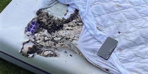 Teen burned after iPhone charger allegedly caught fire on bed